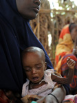 مجاعة الصومال