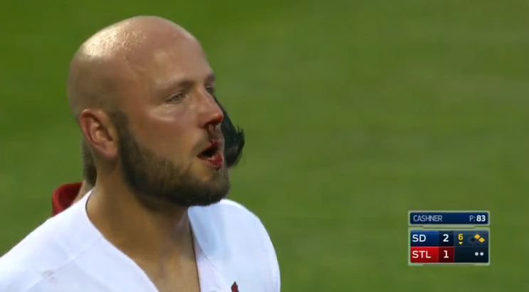 Matt Holliday had a bloody nose after taking a pitch to the face. (MLB.com Screenshot)