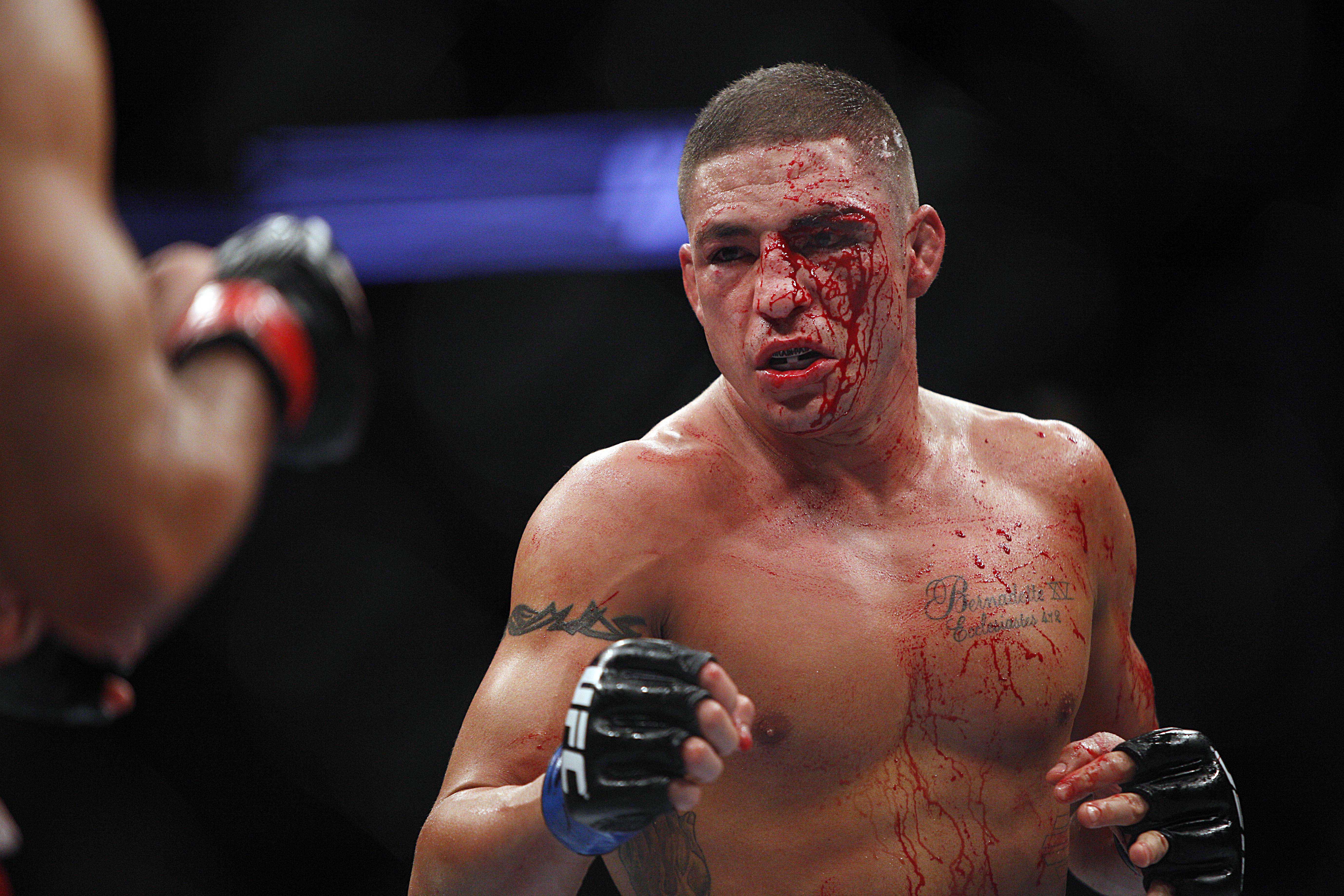 A cut above Diego Sanchez's left eye had him bloody early on Saturday. (USA Today)