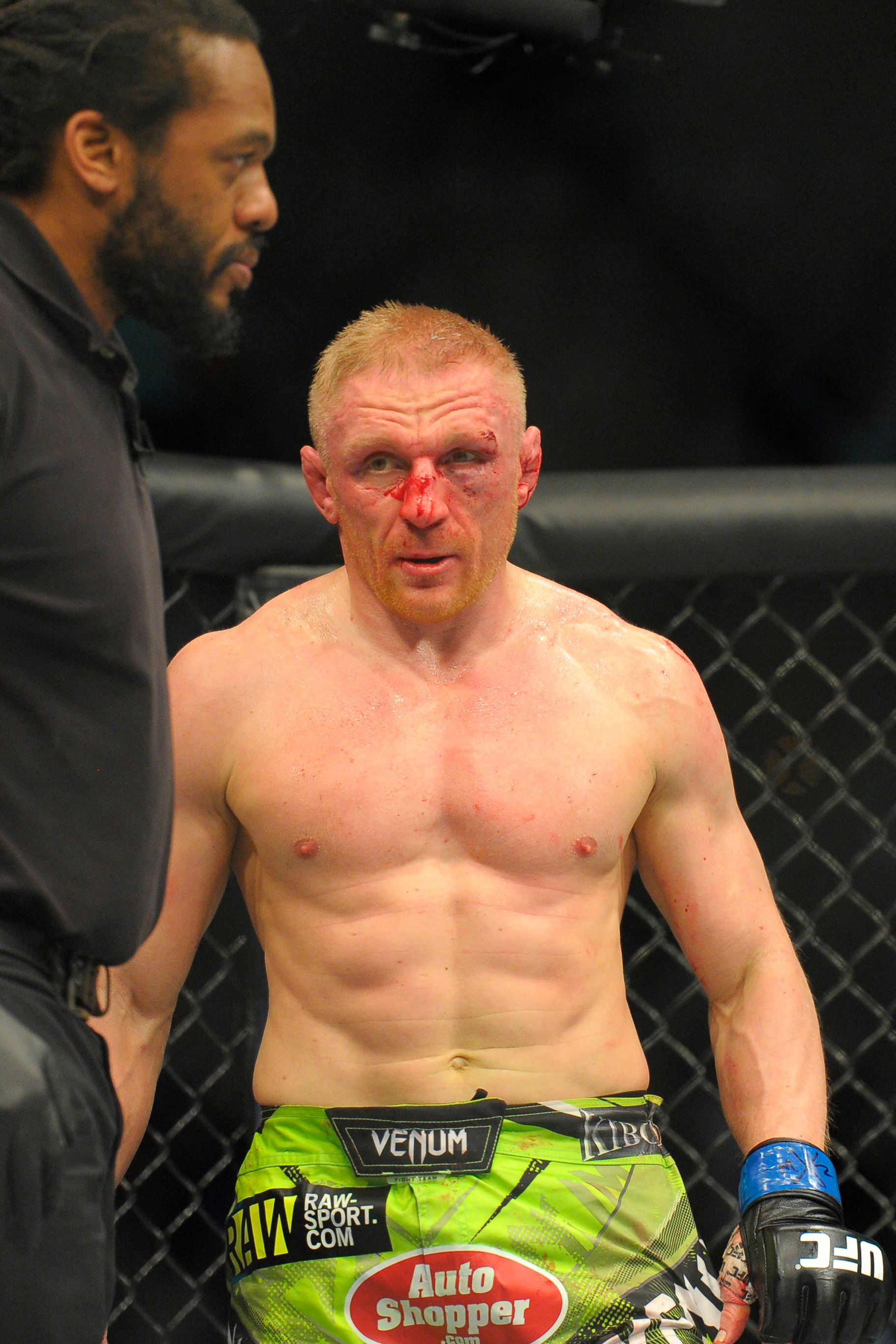 Jan 18, 2015; Boston, MA, USA; Dennis Siver after his loss to Conor McGregor (not pictured) during a featherweight bout at UFC Fight Night at TD Garden. (Bob DeChiara-USA TODAY Sports)