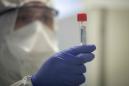 How can I get tested for coronavirus? What you should know about test kits