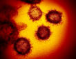 US OKs 1st coronavirus test that allows self-swab at home