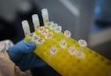 Germany Eyes 1 Billion Euros For Virus Research, Equipment