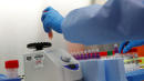 CDC tested only 77 people this week; coronavirus testing slow around the nation