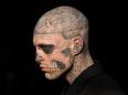Canada's Zombie Boy dead of apparent suicide at 32